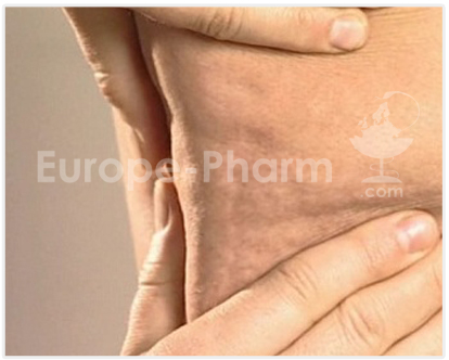 man-cellulitis-ALT_BIG_IMG