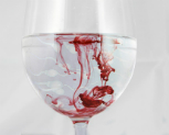 Blut im Sperma