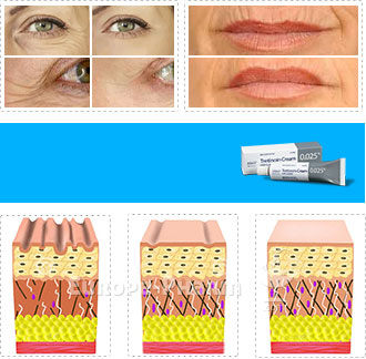8076_banner_diagramm