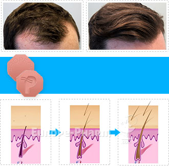 551_banner_diagramm